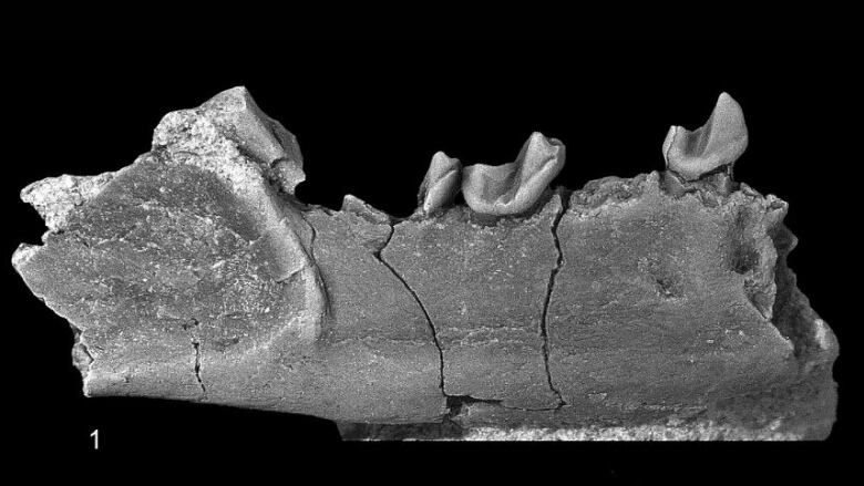 The image shows jawbones and teeth in black and white. 