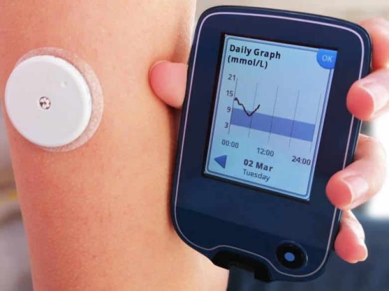 Continuous glucose monitors or CGM with sensor and screen displaying graph of levels.