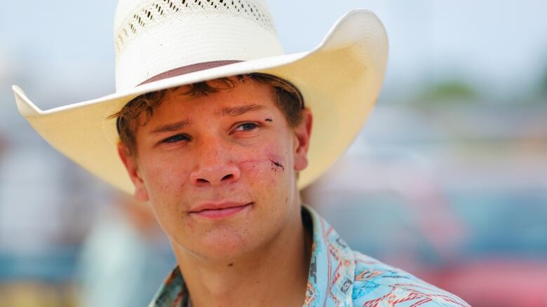 A young cowboy has cuts and bruises on his face.